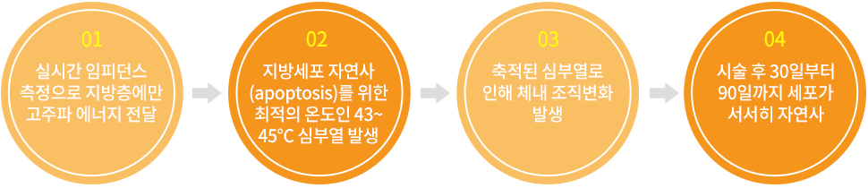 뱅퀴시 시술효과