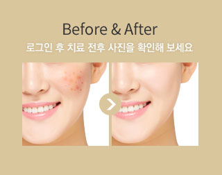 Before&After